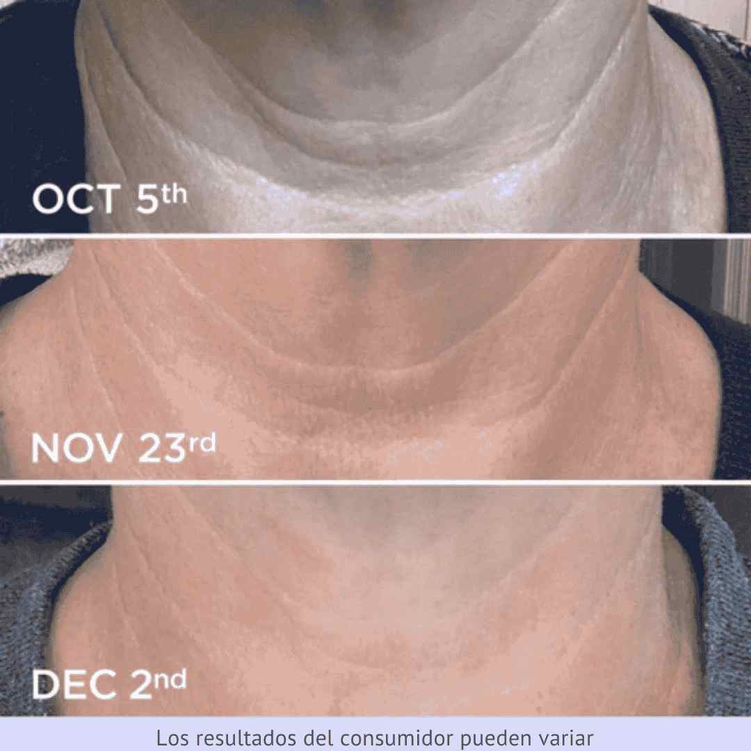 tighten & lift® - CREMA REAFIRMANTE Y TONIFICANTE PARA EL CUELLO
