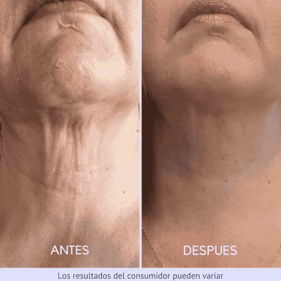 tighten & lift® - CREMA REAFIRMANTE Y TONIFICANTE PARA EL CUELLO