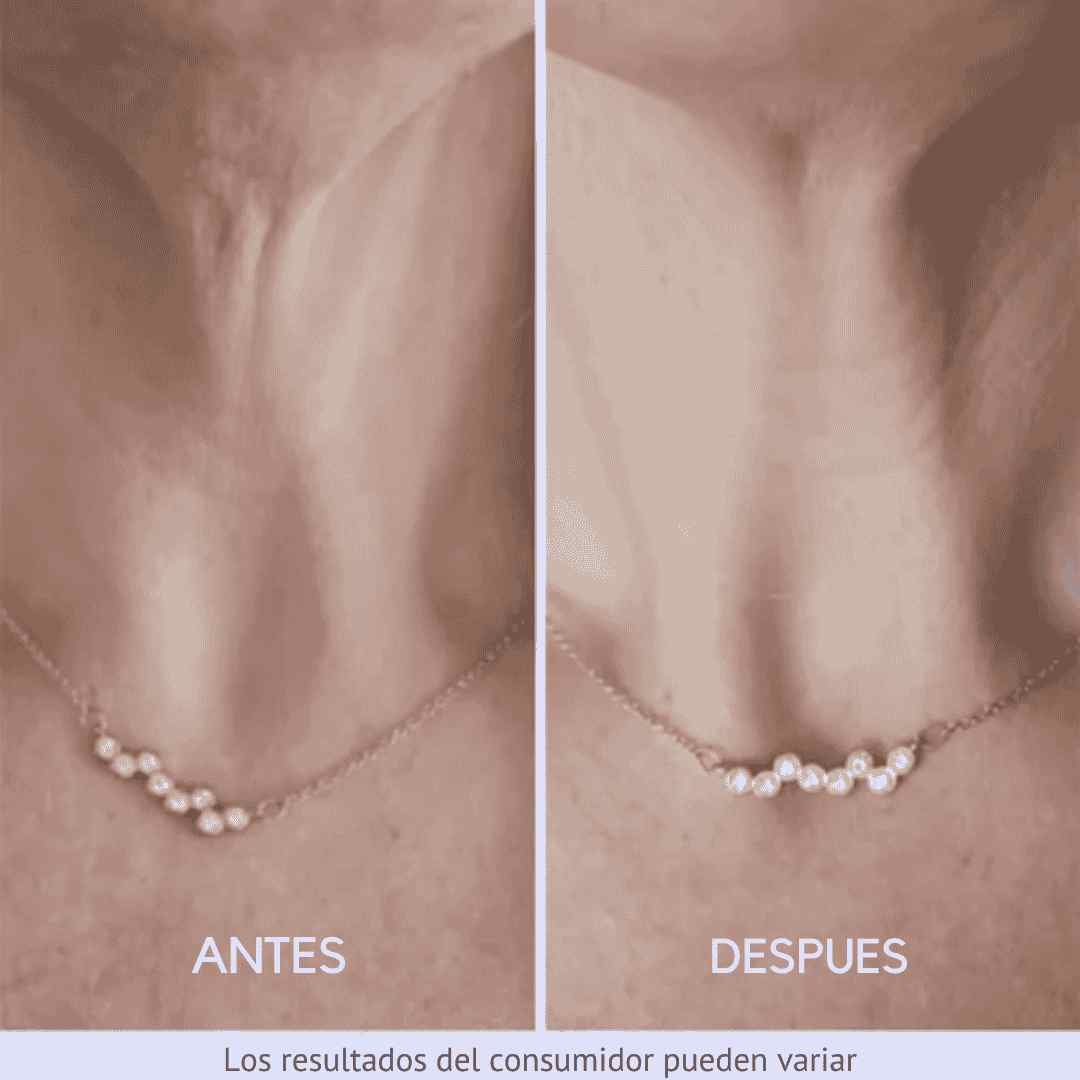 tighten & lift® - CREMA REAFIRMANTE Y TONIFICANTE PARA EL CUELLO