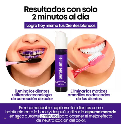 Purple Smile™ - Crema de Dientes Blanqueadora