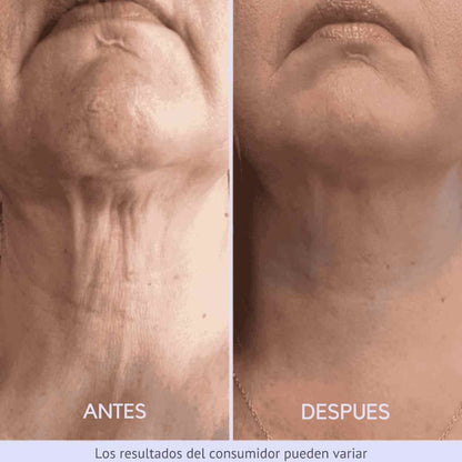 tighten & lift® - CREMA REAFIRMANTE Y TONIFICANTE PARA EL CUELLO